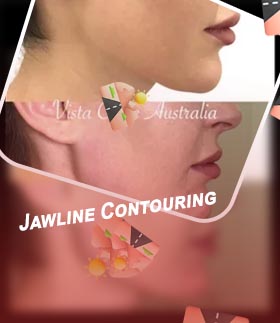 Asian jawline tool